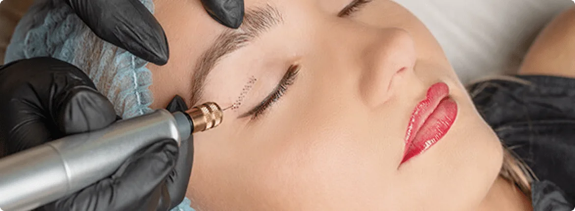Fibroblast Skin Tightening