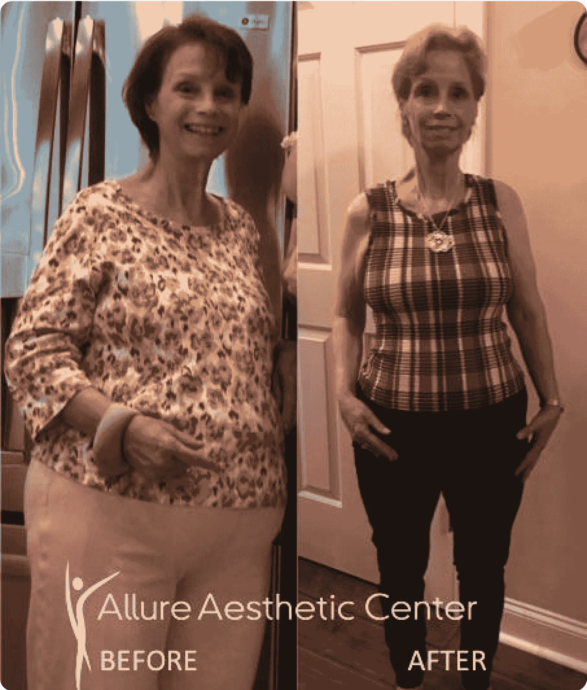 L hCG weight loss alpharetta