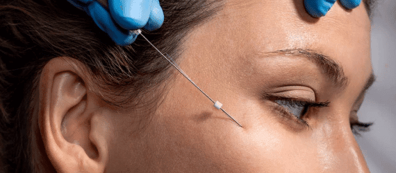 Mask-Group-18 Woman getting her face injected