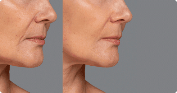Mask-Group-23 Comparison
