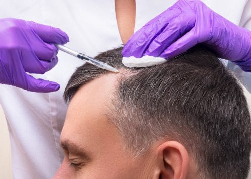 PRP Hair Restoration PRP Hair Restoration