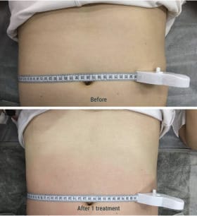 Group-284 Before After Treatment