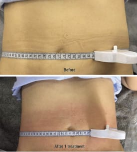 Group-287 Before After Treatment
