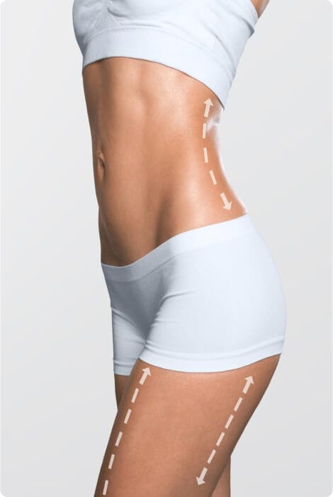 UltraShape UltraShape
