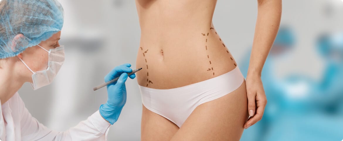 fat-reduction fat-reduction