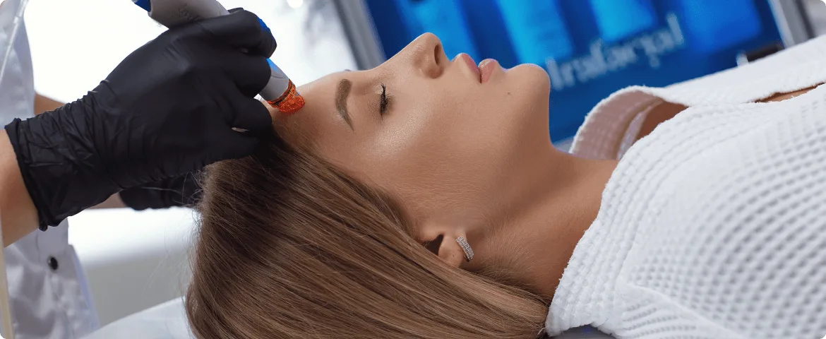 microdermabrasion-allure