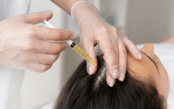 microneedling-img-3 microneedling-img-3