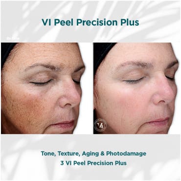 Tone-Texture-Aging-Damage