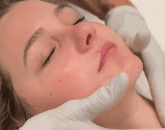 Benefits-of-Dysport-Alpharetta Benefits-of-Dysport-Alpharetta