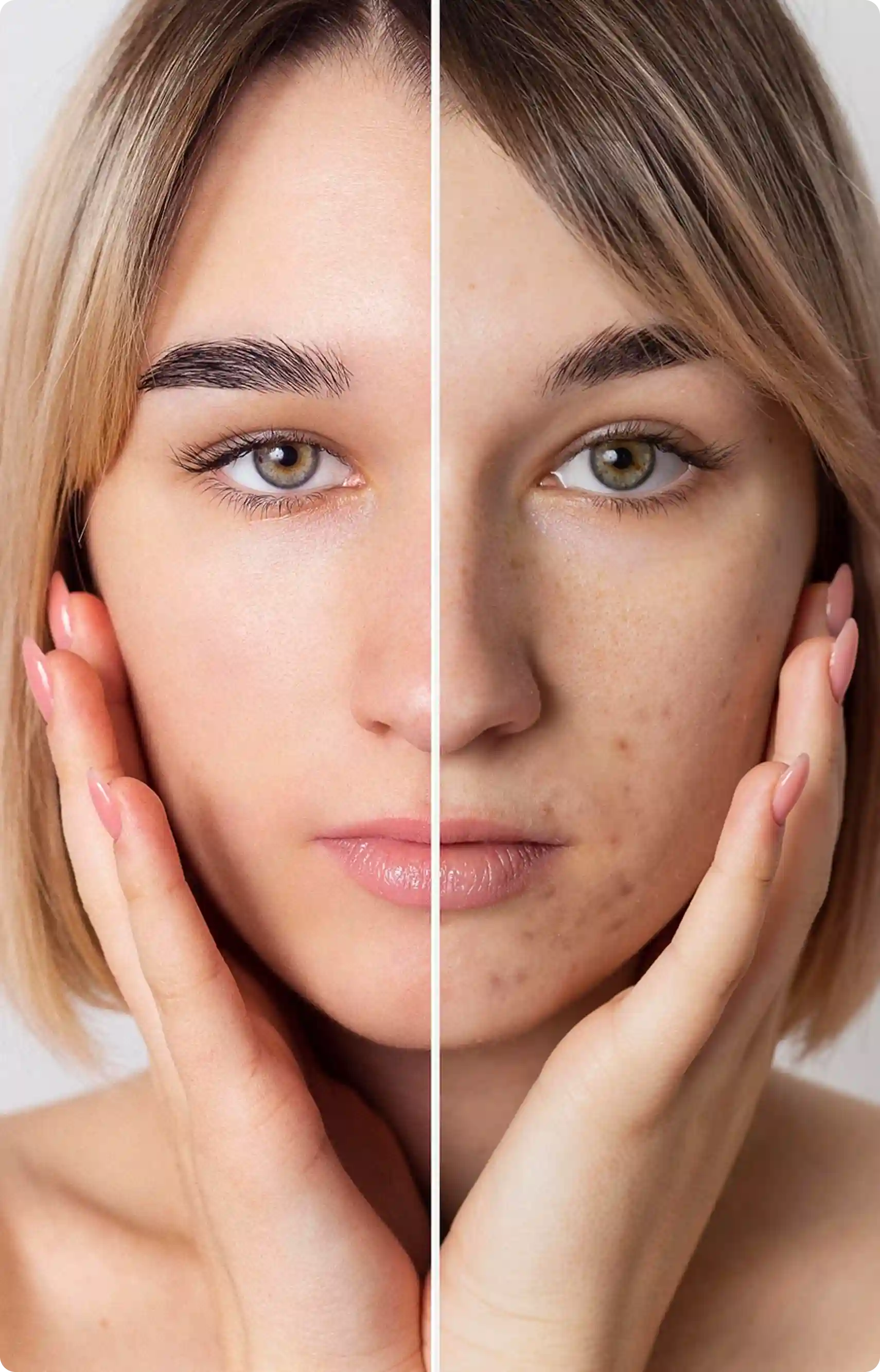 Laser Skin Resurfacing Safe Laser Skin Resurfacing Safe