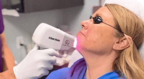 Utilizing-diode-laser Utilizing-diode-laser
