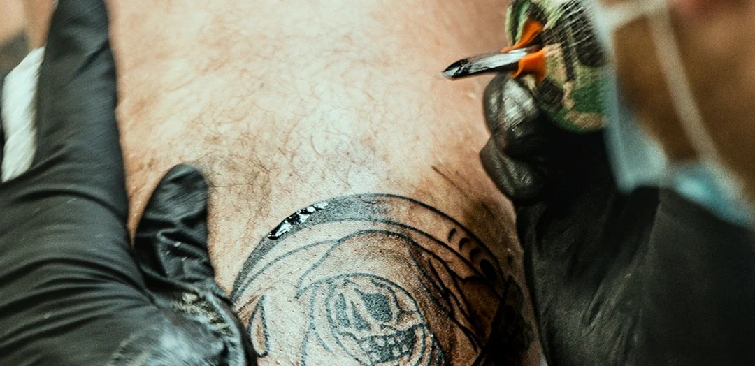 How Many Sessions Does Laser Tattoo Removal Take?