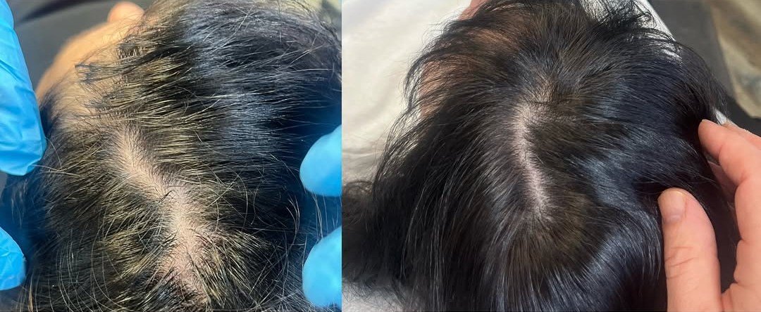 vitti pure hair before after