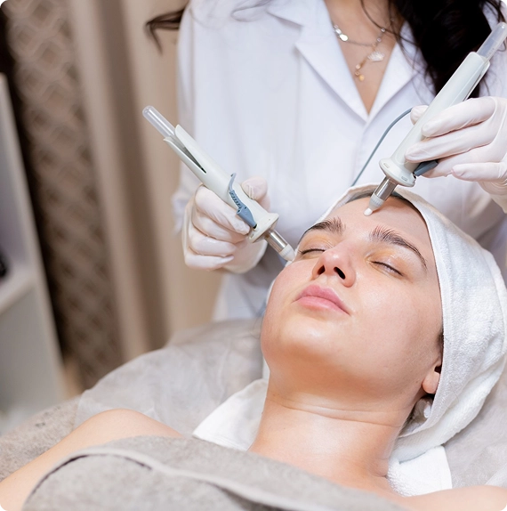 Acne Scars and Laser Treatments