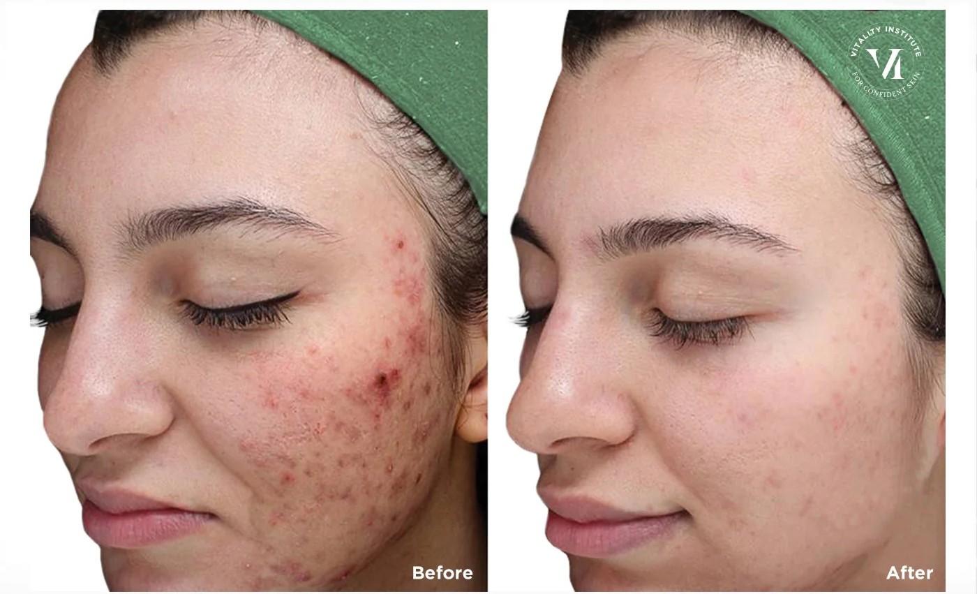 ezgif.com-webp-to-jpg-converter (17) Body Sculp in 250 dollar