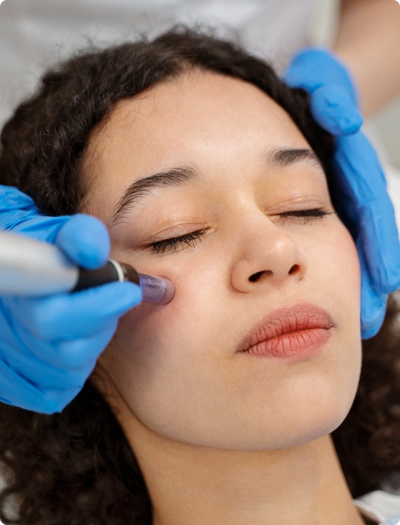 Aquagold Microneedling vs. Traditional Microneedling Techniques img