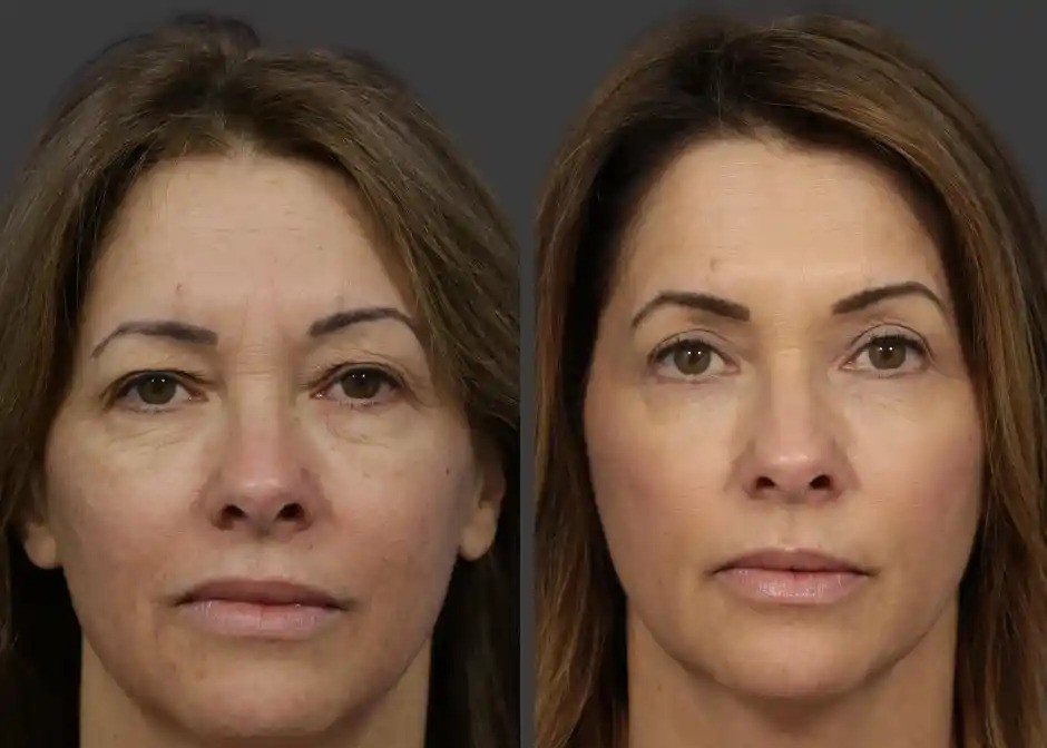 ezgif.com-webp-to-jpg-converter (20) rff