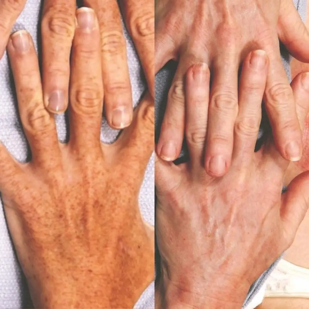 BodySculpt in 250 dollar