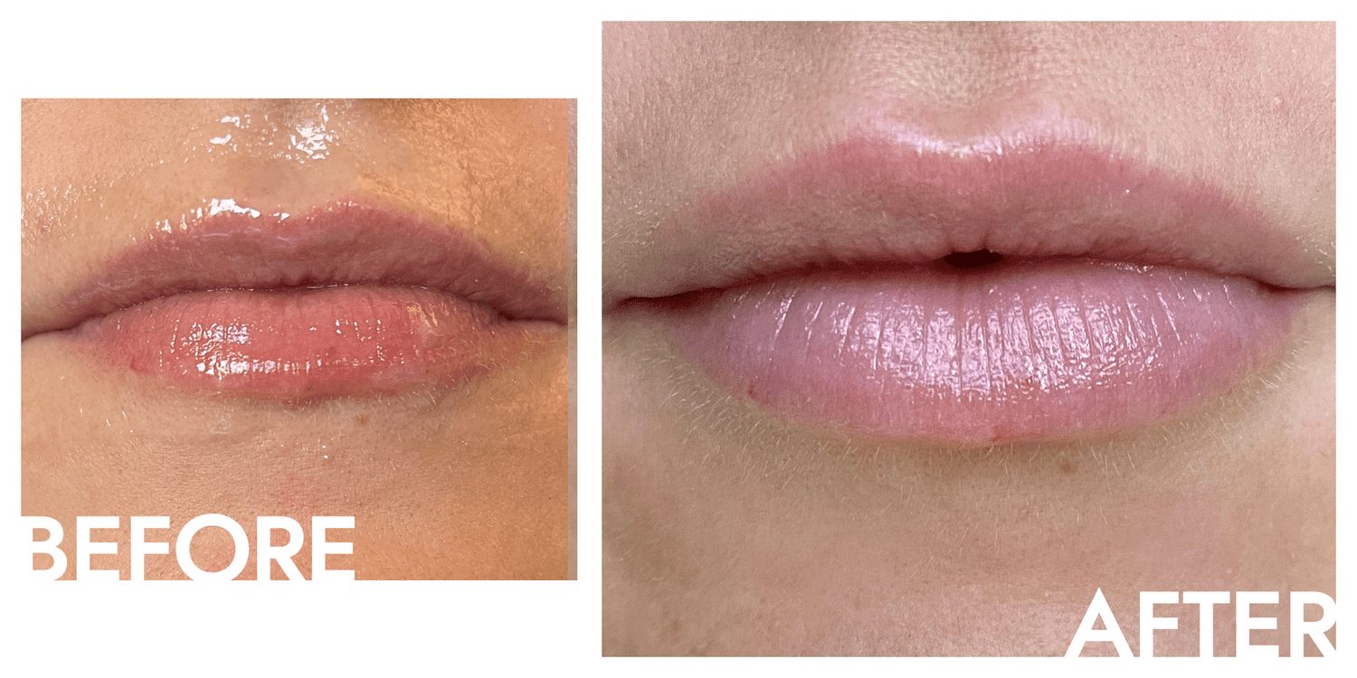 BodySculpt in 250 dollar