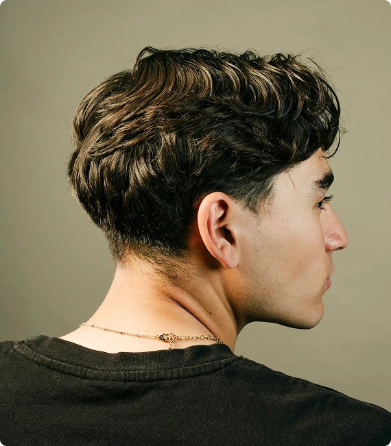 Is PRP Hair Restoration Right