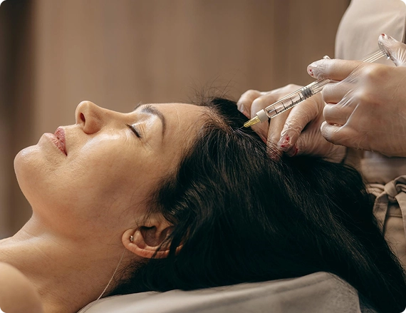 PRP for Different Types of Hair Loss