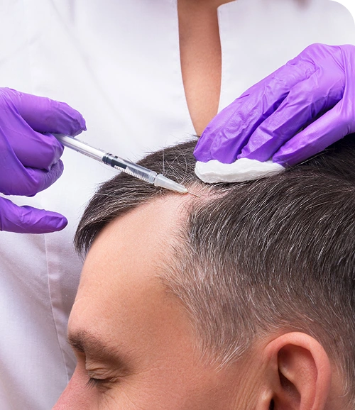 PRP hair growth therapy img PRP hair growth therapy