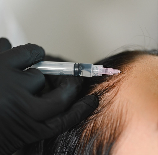 Conditions Treated with PRF Hair Restoration img Conditions Treated with PRF Hair Restoration